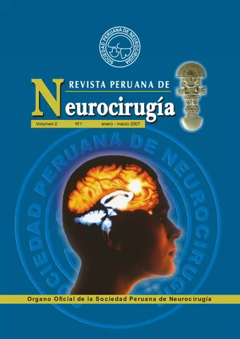 Asociación de hematoma sudural y quiste aracnoideo en niños cristian salazar