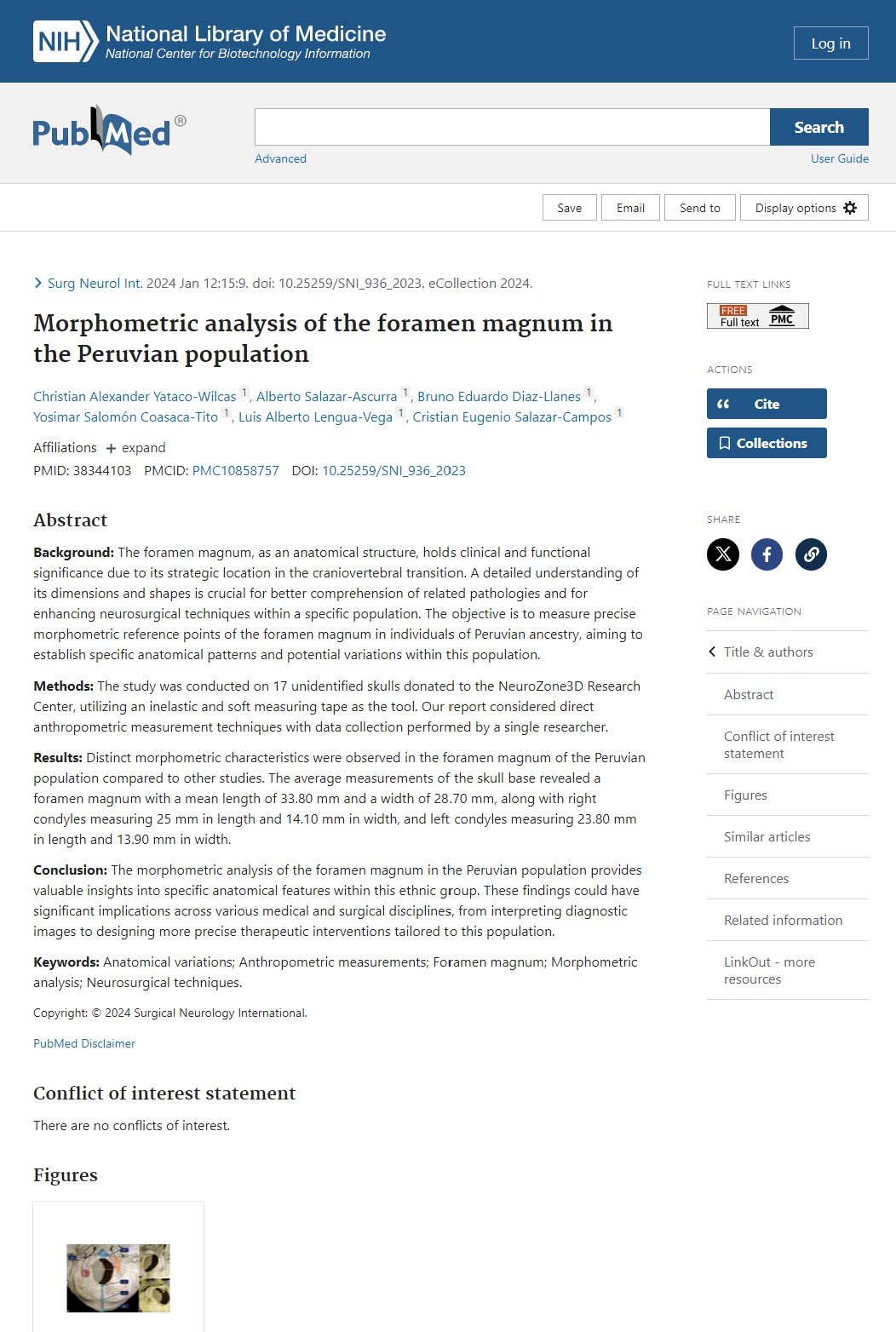 Morphometric analysis of transsphenoidal surgery in Peruvian population cristian salazar yataco wilcas