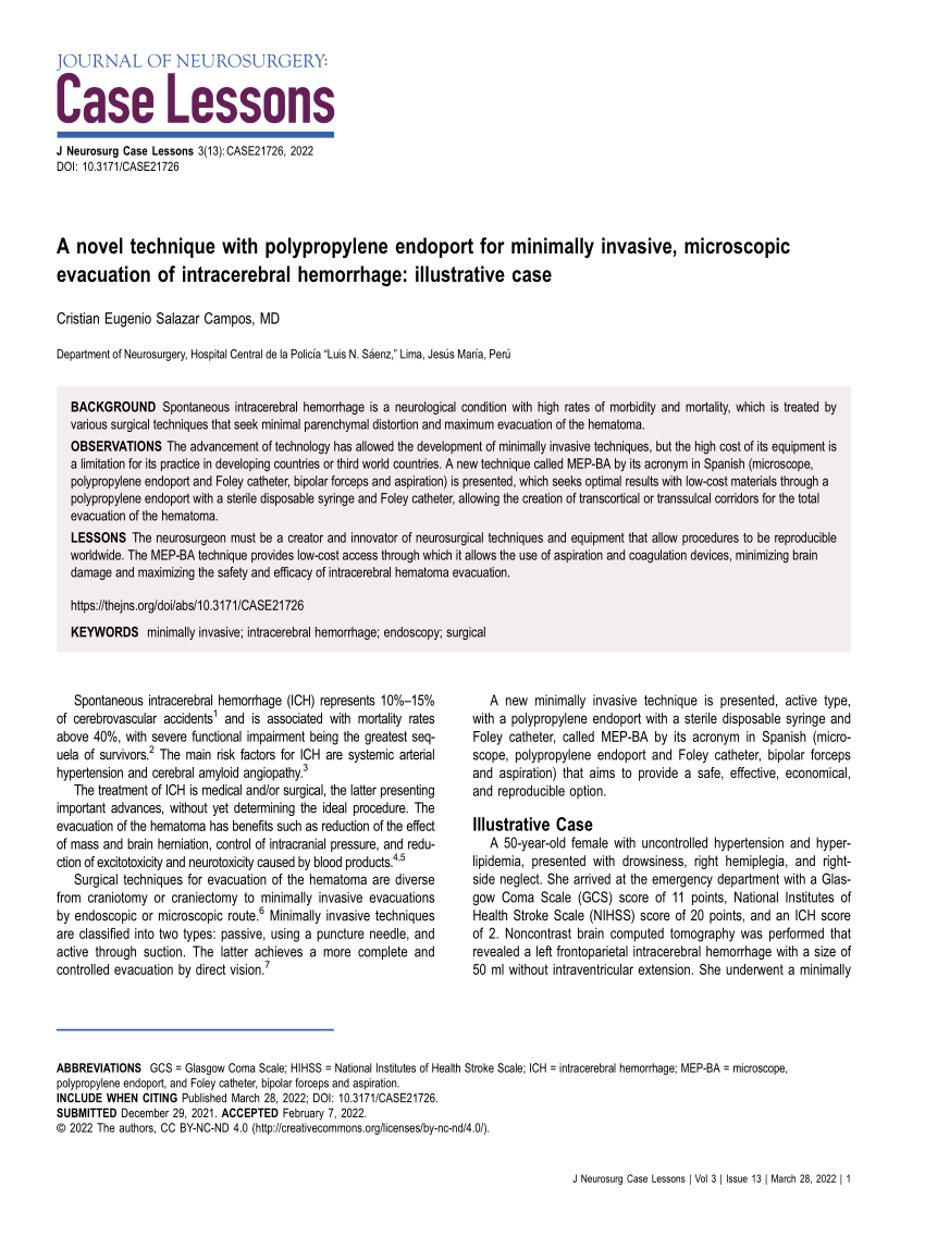 Novel technique with polypropylene endoport for minimally invasive. Journal of Neurosurgery – Case lessons. Cristian salazar